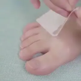 Glue Free Toenail Patch @neulonsofficial @amazon @walmartworld #toenailrepair #toenailpatch #shopnow