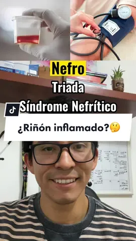 TRIADA SD. NEFRÍTICO🧐  El sd nefrítico se caracteriza por lo sgte: -Proteinuria (rango no nefrótico <3.5g/24horas) -Hipertensión Arterial -Hematuria  También puede presentar azoemia, oliguria y edema  Espero les sirva! Éxitos!💯😁  #nefrologia #riñon #medicina #estudiantedemedicina #medlife #enam #drinsulinoma #essaludperu #minsaperú #internadomedico #medico #triada #sindromenefritico #glomerulopatias #hematuria #hta #edemarenal 