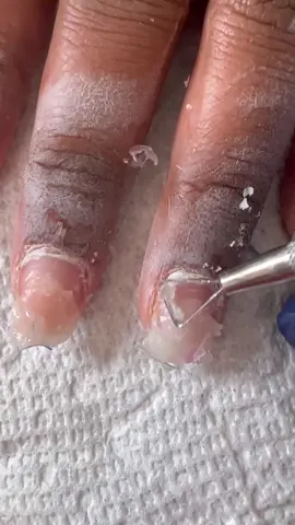 Si haces uñas o eres clienta debes saber qué hay muchas personas trabajando con los productos incorrectos, ya sea por desconocimiento o economía porque son más baratos,  El punto es que el monomero incorrecto que utilizan tiene un ingrediente que se llama MMA “Methyl Methacrylate” el cuál es Ilegal, es un material que es para trabajar con prótesis dentales no con uñas, este causa muchos daños a la uña natural, ademas que es más difícil trabajarlo no se autonivela, se pone amarillento y es un caos para retirarlo, parece un chicle como lo pueden ver en el video.. El Monomero correcto debe contener EMA “Ethyl Methacrylate” este monomero se autonivela, de mantiene cristalino, NO DAÑA LA UÑA NATURAL, y es fácil de retirar.. revisa la etiqueta del Monomero que estás Usando y haz los cambios en caso de que estes trabajando con el incorrecto.. espero les sirva esta Información  • • • #nails #mma #ema #monomero #monomer #product #gabynailsnyc #mmamonomer #emamonomer #acrylic #acrylicnails