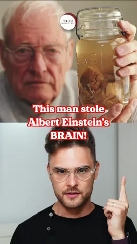 He STOLE Albert Einstein's brain! 😲 #projectnightfall #brain #alberteinstein #einstein #genius #viral #science #scienceexperiments #trivia #facts