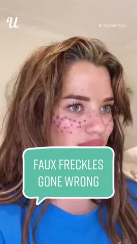 For anyone thinking of tattooing freckles onto their face… 😳 (@tillywhitfeld) #fauxfreckles #freckles #fail #DIY 