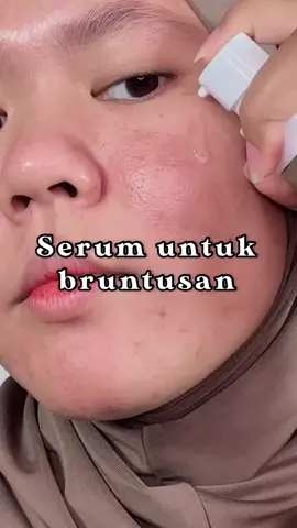 Lika liku ngatasin jerawat dan bruntusan😩 #serumviral #acneserum 