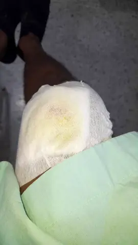 mi primera caida en moto con raspones bastate grades 