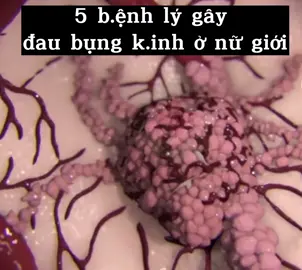 nguyên nhân gây đau bụng kinh ở nữ #dsphuongtham2022 #xuhuong2022 #viêmnhiễmphụkhoa  giới