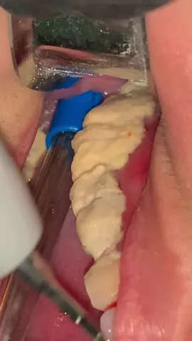 ⚠️