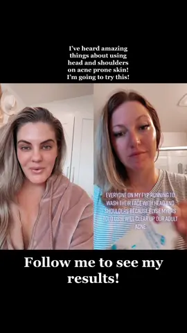 #duet with @crissyfoster426 #FlexEveryAngle #stitch #skincarehacks #skincareroutine #acnetreatment #skincaretips #acne 