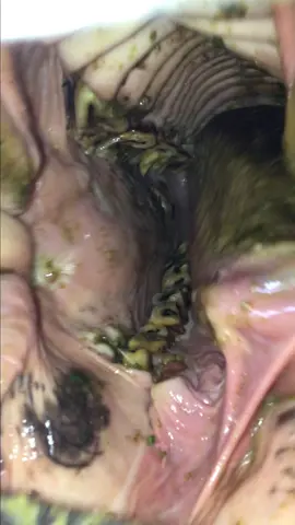 See my pinned video for details and follow to see what it takes to rehab (vet farrier dentist chiro worming ulcergard feed exercise…the list goes onnnnn) These two will be my 24th and 25th rehabs and my 14th and 15th surrenders to live out the rest of their life with me and my clients 🥰 @TractorSupply #DACoil #ulcergard 