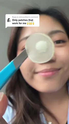 Replying to @skincarefeen This is your sign to stock up on Mighty Patches before your next breakout (or pimple) sneaks up on you  #herocosmetics #mightypatch #heromightypatch #pimplepatch #patchpeel #pimplepatchremoval #skincareforacne #breakoutacne 