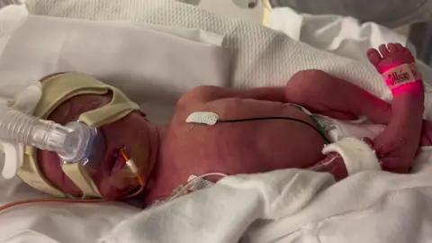 Big chilling! #sipapmachine  #blackhawkfamily #momof5 #preeclampsia #grangerleestrong #nicu #DidYouYawn #30weekerpreemie #30weeker #viral #viral #awareness #viral #fyp 