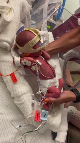 First time holding him 💙#blackhawkfamily #preeclampsia #preeclampsiaawareness #preeclampsiasurvivor #30weekerpreemie #30weekerpremmie #30weekerbaby #grangerleestrong #fypシ #Love #nicu #nicubaby #nicumom #proud #sweetmoments 
