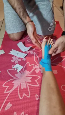 Morton's Neuroma taping #physicaltherapy #healing #kinesiotape 