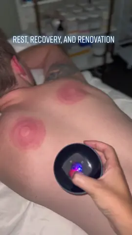 EaseUpPlug is 🔥🔥 #newbusiness #cuppingtherapy #tiktokmademebuyit #viral #fyp #funny 