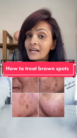 Treating brown spots #brown #brownspots #browngirl #hyperpigmentation #hyperpigmentationtreatment #darkspots #howto #dermatologist #retinol 