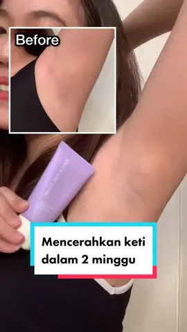Ketinya jadi CERAH???✨ @Grace and Glow Indonesia #RekomendasiTiktok #RekomendasiDeodorant #GraceandGlow