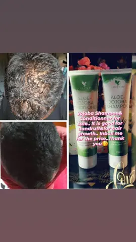 #aloejojobashampoo & #aloejojobaconditioner  à vendre/For sale.. #follow moi et #Inbox moi pour le prix svp😊 #hairgrowth #antidandruff #naturalproducts #bioproducts 