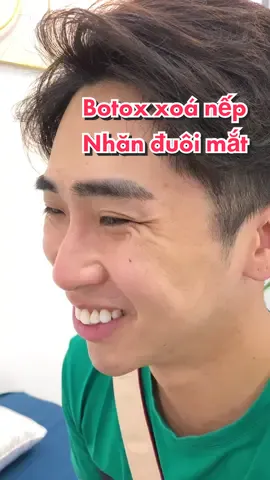 Tiêm xoá nếp nhăn đuôi mắt #tiembotoxxoanhan #tiemxoanhan 