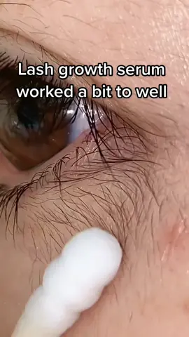#eyelashes #lashgrowth #uk #makeuphacks #amazing 