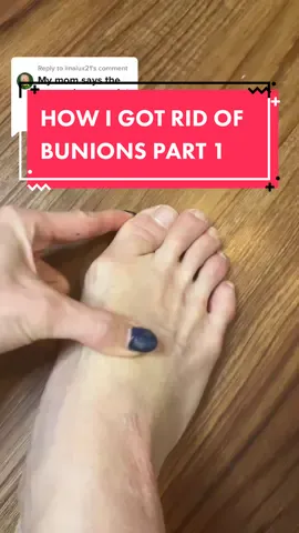 Replying to @linalux21 preventing bunions🦶🏼😭 #bunions #dancerlife #balletgirlsz #pointeshoes #dancerfeet #ballerinacheck #balletdancer #nycdancer 