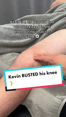 Have you seen swelling like this before!? Let me know below 👇🏼 #physiobae #kneepain #kneeswelling #soccerinjury #physio 
