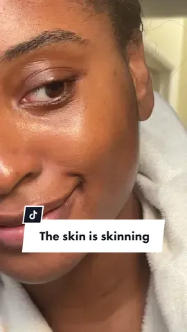 It’s the skin for meeee 🍩 