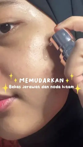 bekas jerawat yang susah hilang sekarang hempas cuman pakai serum ini🤩 #fyp #darkspotserum   