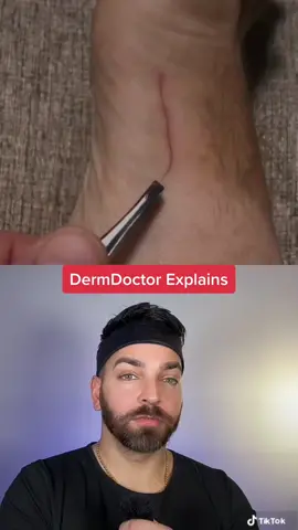 What movie were they watching? @cavefaceq #dermdoctor #dermatologist #skincare #hairsplinter #barber 