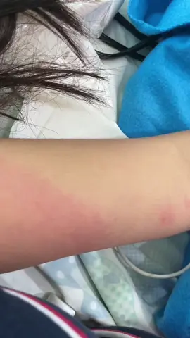 Blood transfusion reaction 🤧. 3rd bag hopefully enough na 🥺