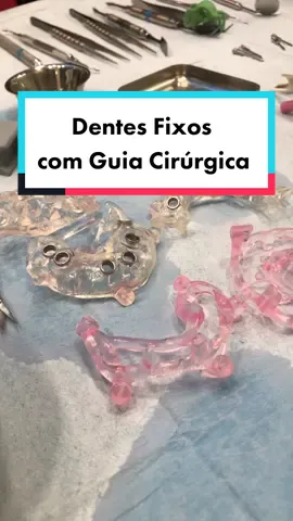 A colocação de Dentes Fixos através de uma Cirurgia Guiada 🧐

Com um planeamento digital, é criada uma guia cirúrgica. No dia da cirurgia, além de os implantes ficarem no sítio correto, calculado ao nano milímetro, são colocados dentes provisórios que encaixam na perfeição.

#implantologia #implantedentario #perfectsmile #ceramicimploant #implantesemceramica #implasntesdentarios #indolor #zirconiaimplant #implantology #teeth #dentalimplants #dentalimplant #dentista #guiacirurgica #guidedsurgery #computerguidedsurgery
