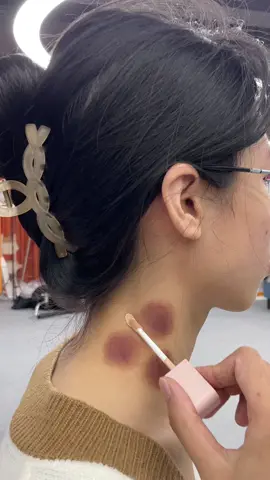Have you ever had any kiss marks that are particularly embarrassed?#cosmetics #makeup #fyp #concealer 