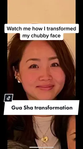 Huge Gua Sha transformation! Can’t believe I used to look like this😭😫😫😫 can’t live without Gua Sha anymore🫶❤️ #chubbyface #roundface #guasha #transformation #7mos #lympathicdrainage #massage #skincare 