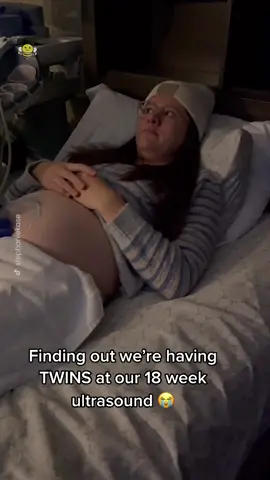 They found out on their first ultrasound 😮 #fyp #foryoupage #ultrasound #twins #twinmom #pregnancy #reaction  