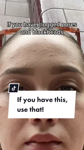 If you have this, use that! #cloggedpores #blackheads #acne #acneroutine #skincaretips #SkinCare101 #skintok #skinbarrier #largepores 