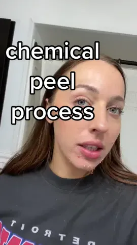 chemical peel 😬 process over a week span #skintok #skincare 