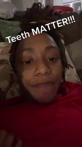 No forreal #teeth #locthugga #locs #teethmatter #canthelpit 