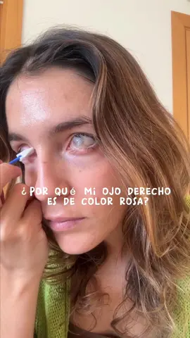 La pregunta del millón, ojalá poder hacerme una camiseta que lo resuma todo para que la gente que no me conoce y me vea por la calle deje de mirarme como a una marciana🙃 #blind #injertodemucosa #mucosabucal #bkpro #bkproblems #ojorosa #ojorojo 