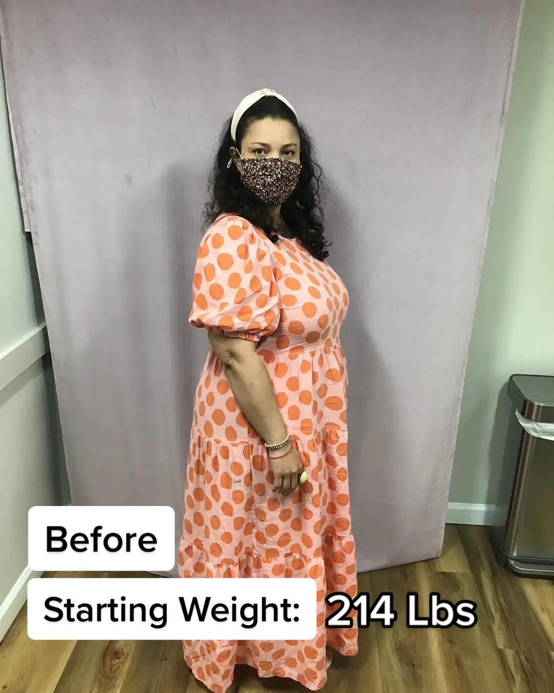 53 LBS LOST IN 6 MONTHS! W/ The Orbera Gastric Balloon #beforeandafterweightloss #weightlosstransformation #gastricballoon #wls