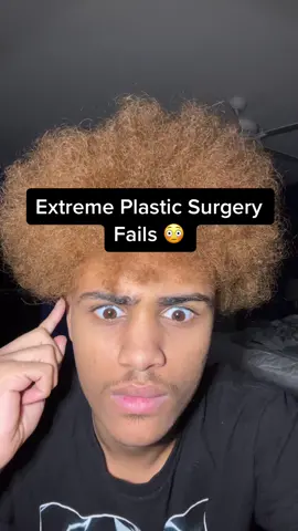 Extreme Plastic Surgery Fails 😳 #fyp #xyzbca #viral #fypシ #foryoupage 