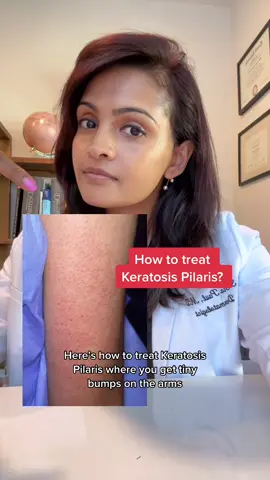 How to treat Keratosis Pilaris with @Glytone #keratosispilaris #roughskin #dryskin #glytonepartner #dermatologist #howto #LearnOnTikTok #glytonepartner #glytoneglow #Inverted 