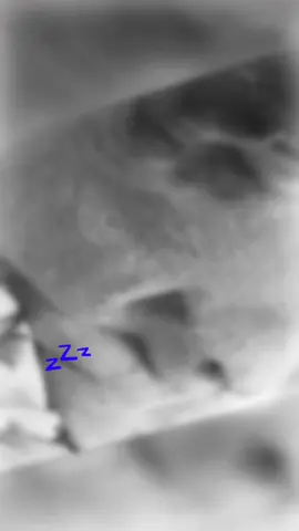 #sleepdog #hyperdog 