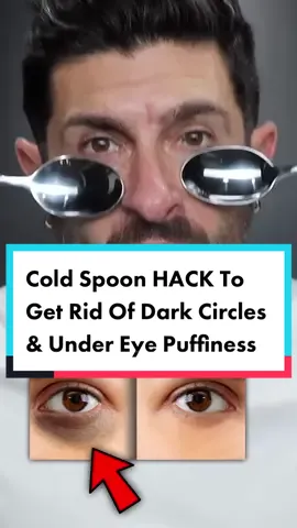 The Cold Spoon HACK To Get Rid Of Dark Circles & Under Eye Puffiness