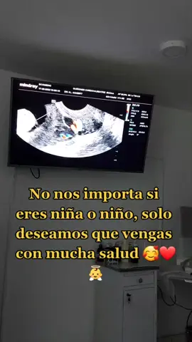 #enladulceespera🤰❤️ #felicespornuestrobb #desde yaa, te amamos mucho 👼😘