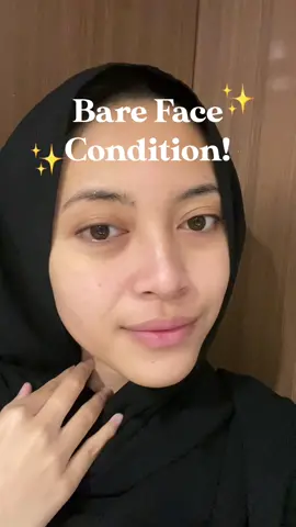 Alhamdulillah jadi makin pede dehh buat bare face🥰🤍 @vipcollagen #vip #vipcollagen #collagendrink 