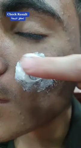 تبييض البيض 🥚 كبسولة. Short Demo..Also mix these capsules in facial bleach polish etc. #GlwANDclean #TiktokGaGa #Beauty #Foryou #Foryoupage #ameenbeautytips @Ameen Cosmetics Center 