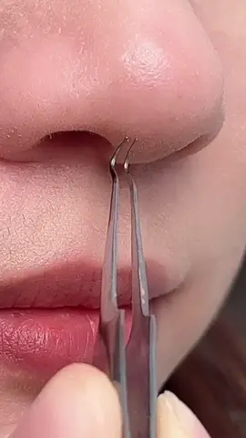 Everyone please try this pimple pooper set! 3different tools in 1 set. Useful and easy to handle! #blackhead #blackheadremovals #acnè #acne #cleaning🥰 #beauty #beauty💕 #tutorials #fyp #fypシ゚viral #fypシ #foryoupage #foryourpage #foryou 