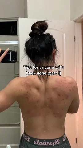 Sharing all of the tips that have helped me (pt. 1) #backacne #bacnetreatment #bacnejourney 