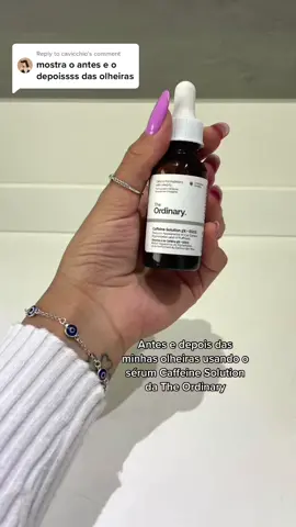Replying to @cavicchio o melhor antes e depois dos últimos tempos😮‍💨 #caffeinesolution #theordinary #antesedepois #olheiras #fy #viral 