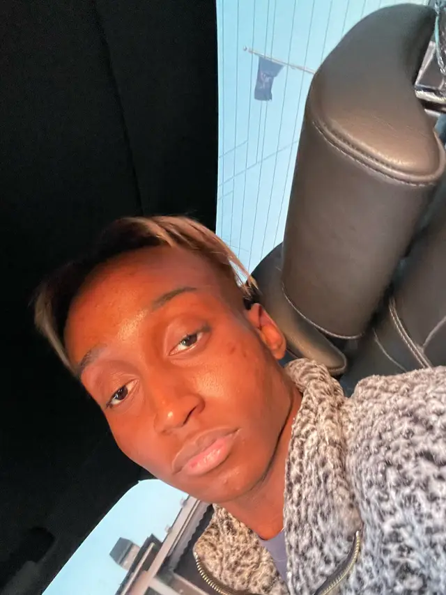 🦇 😳