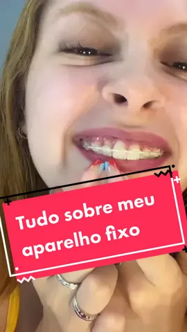Respondendo a @adeliaamelie lembrando q os preços vão mudar de acordo com o dentista e com a sua cidade, tô falando Qnt eu paguei p dar uma noção!!! #aparelhoortodontico #aparelhofixo #aparelhodesafira #aparelhoinvisivel 