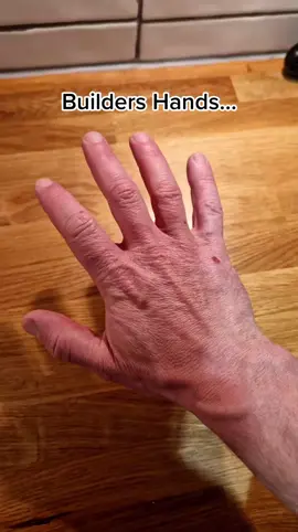 Splitting skin and aching bones! #bricklayer #hands #pain #dry #skin #fypシ 