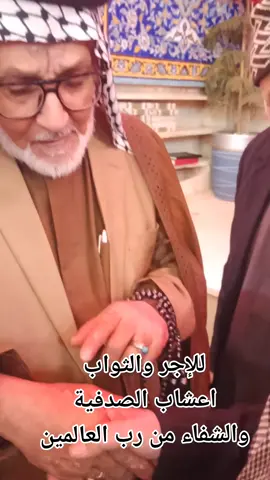 ###مع الخبير ابو امير الكاظمي ### طب الاعشاب ### علاج مرض الصدفية ###والشفاء بيد الله سبحانه وتعالى